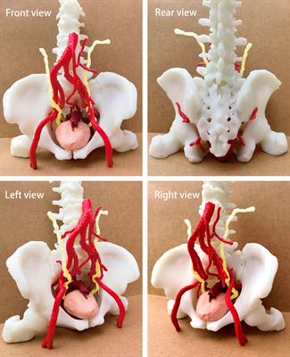 Application of a three-dimensional printed pelvic model in laparoscopic radical resection of rectal cancer